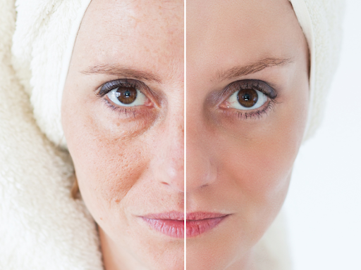 Tạm biệt da sạm xỉn màu